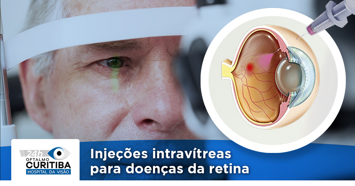 Inje O Intrav Trea Trata Doen As Da Retina Efic Cia Hospital Da