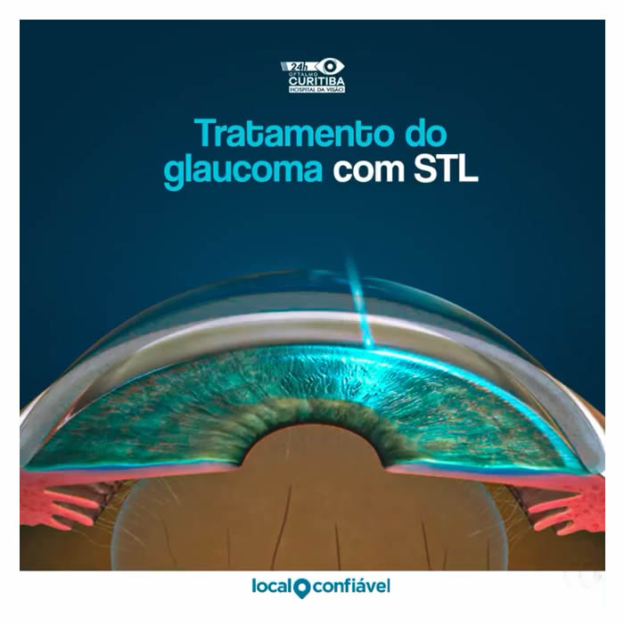 Tratamento Do Glaucoma Slt Hospital Da Vis O Curitiba