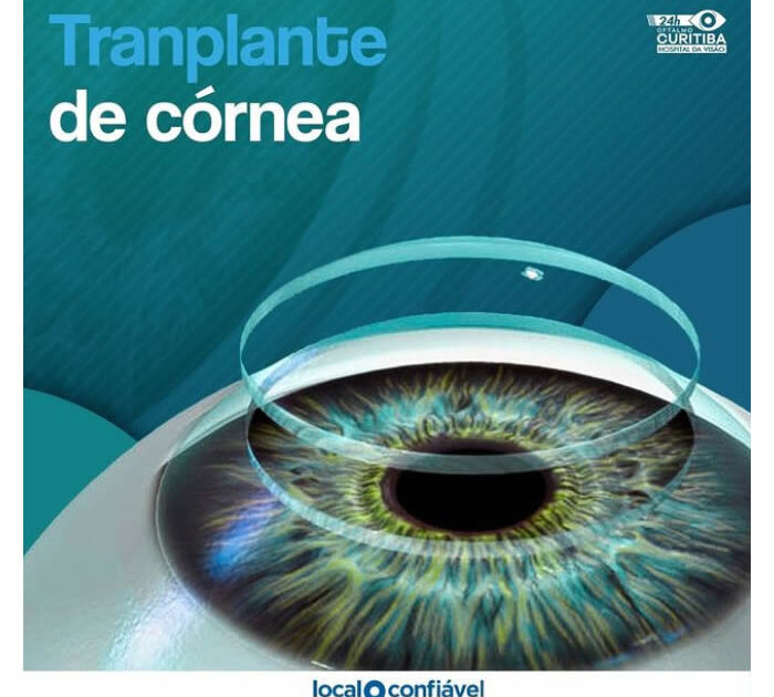 transplante de cornea em curitiba