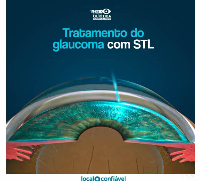tratamento do glaucoma com slt