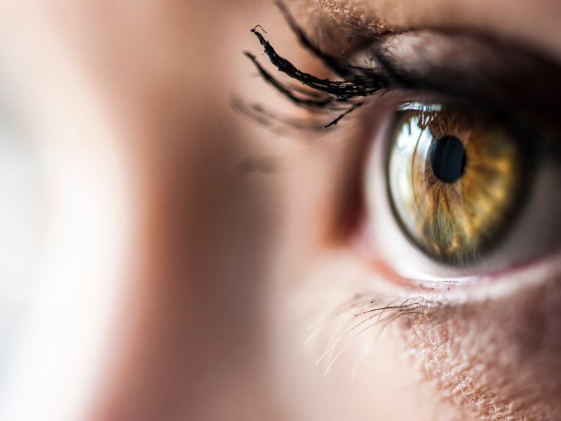 Cirurgia de Estrabismo em Curitiba Tratamento Eficaz para Adultos e Crianças