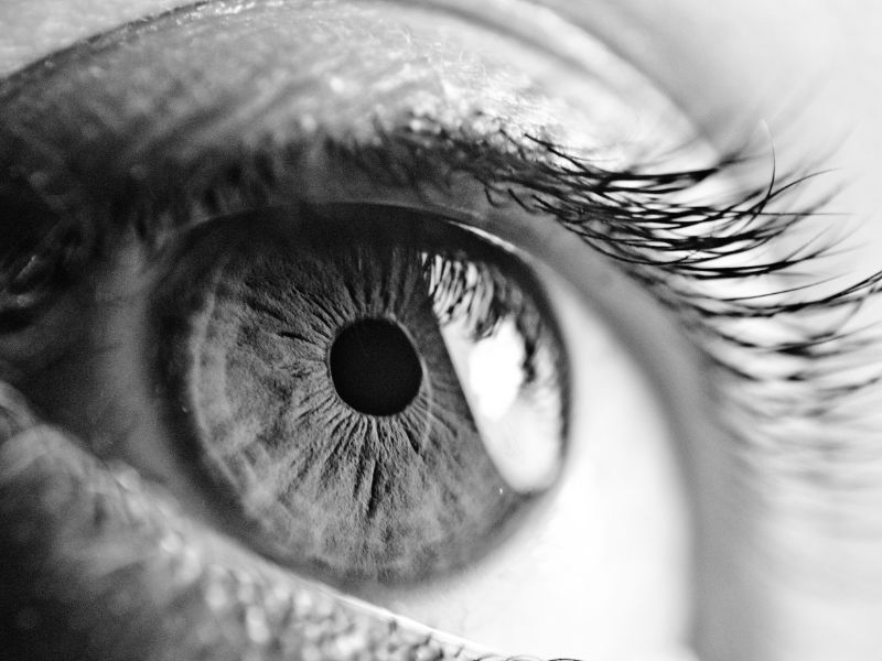 Crosslinking para Ceratocone Leve ou Avançado em Curitiba