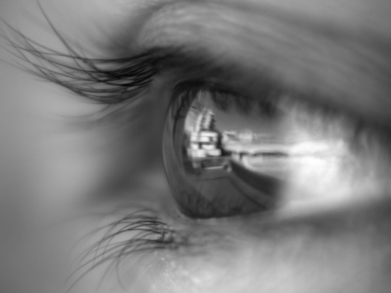 Transplante de Córnea em Curitiba com Médico Especialista